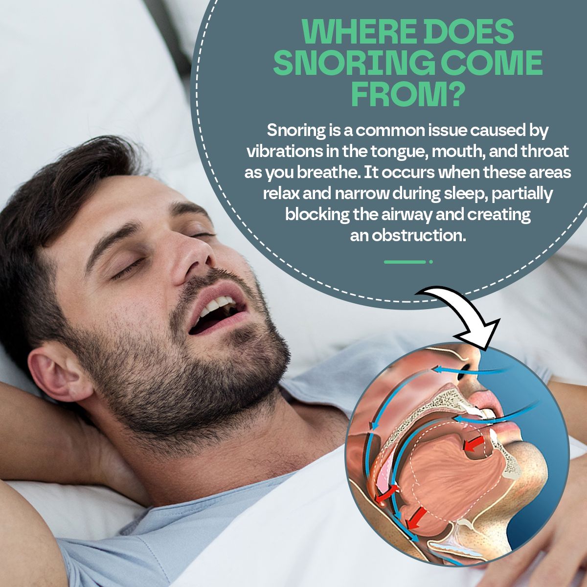 Anti Clench Mouth Guard