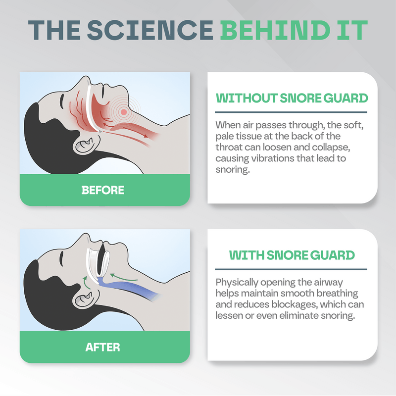 Anti Snore Mouth Guard Pro