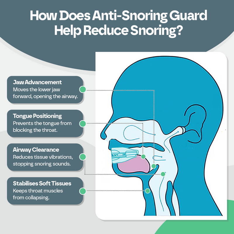 Anti Snoring Mouth  Guard